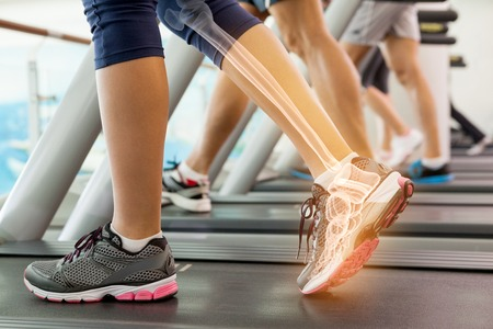 Bone Density and Estrogen Receptor Activity
